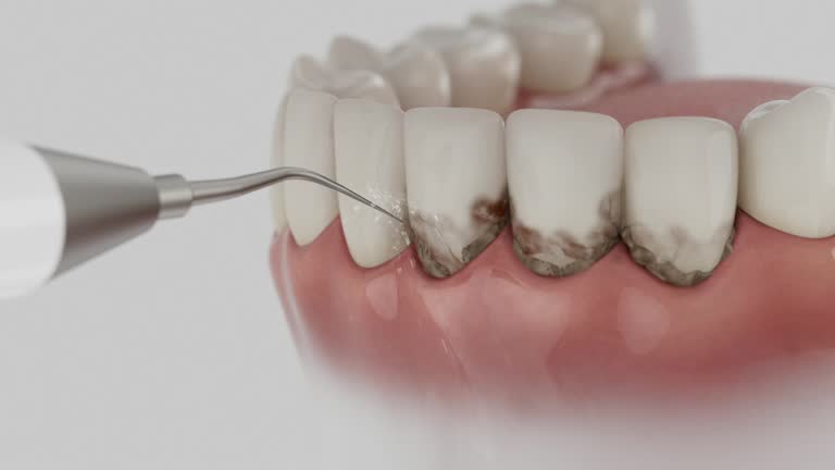 Trusted Wisdom Tooth Removal service in Ambler, PA - Dentist Open Now